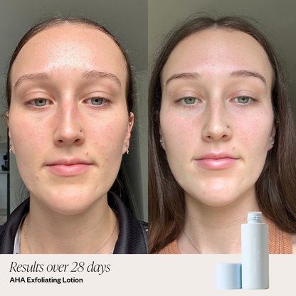 4 Step Brightening System
