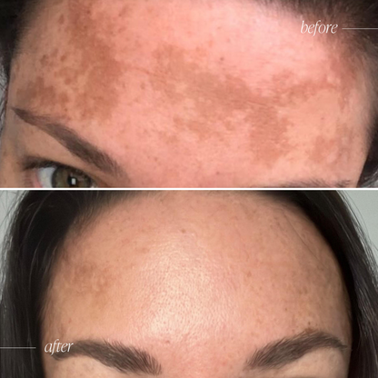 Vitamin C Brightening Serum Complex