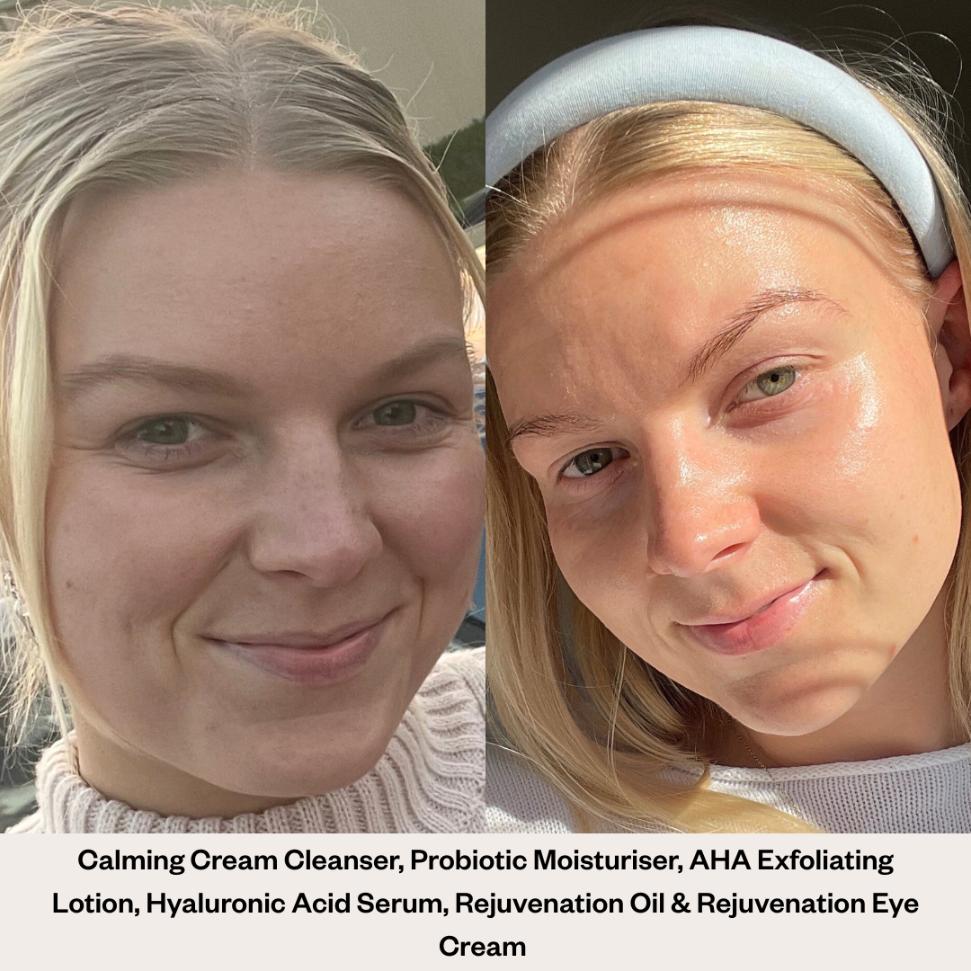 Rejuvenation Oil