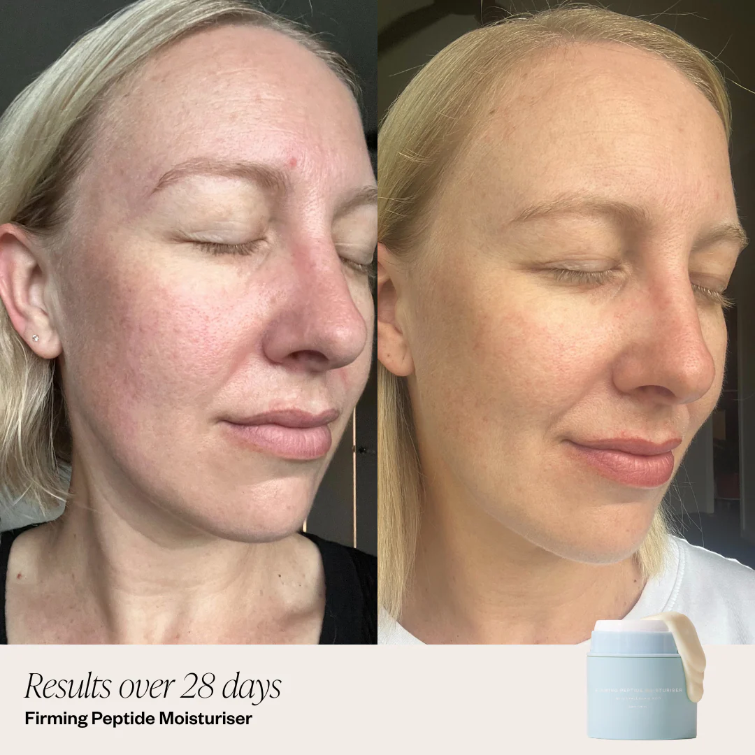 2 Step Firming System