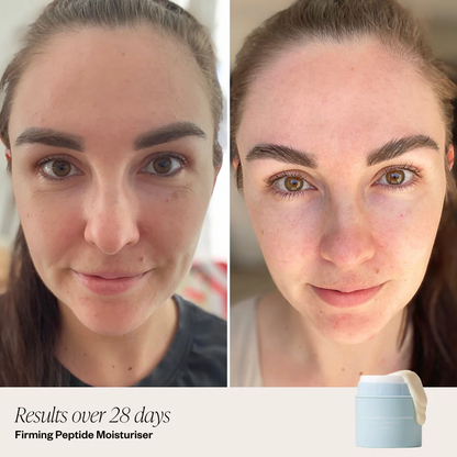 2 Step Firming System