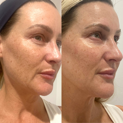 Skincare Try it all Bundle - Trial Size