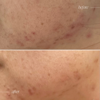 Probiotic Moisturiser +