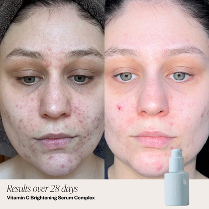 2 Step Clearing Serum System