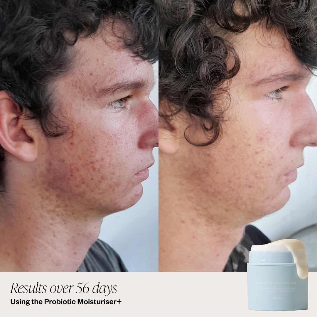 Probiotic Moisturiser +