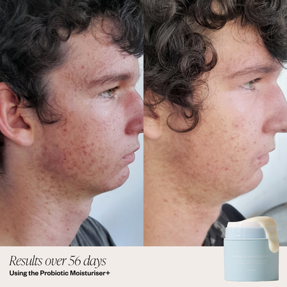 Probiotic Moisturiser +