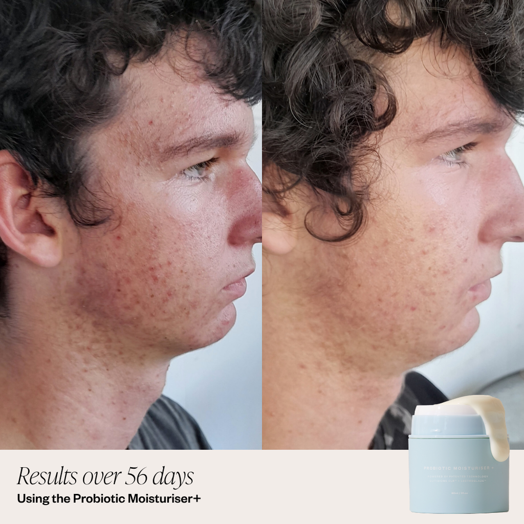 Probiotic Moisturiser + Trial Size