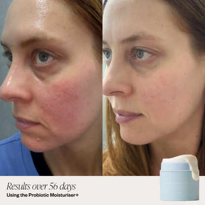 Probiotic Moisturiser +